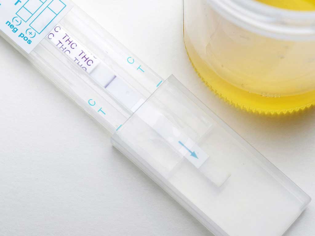 A urine sample next to a cassette showing positive for THC