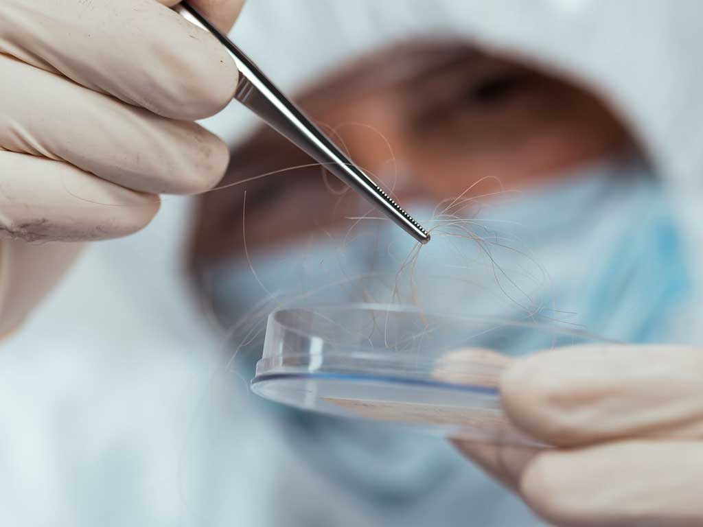 A professional extracting a small hair sample from a petri dish.