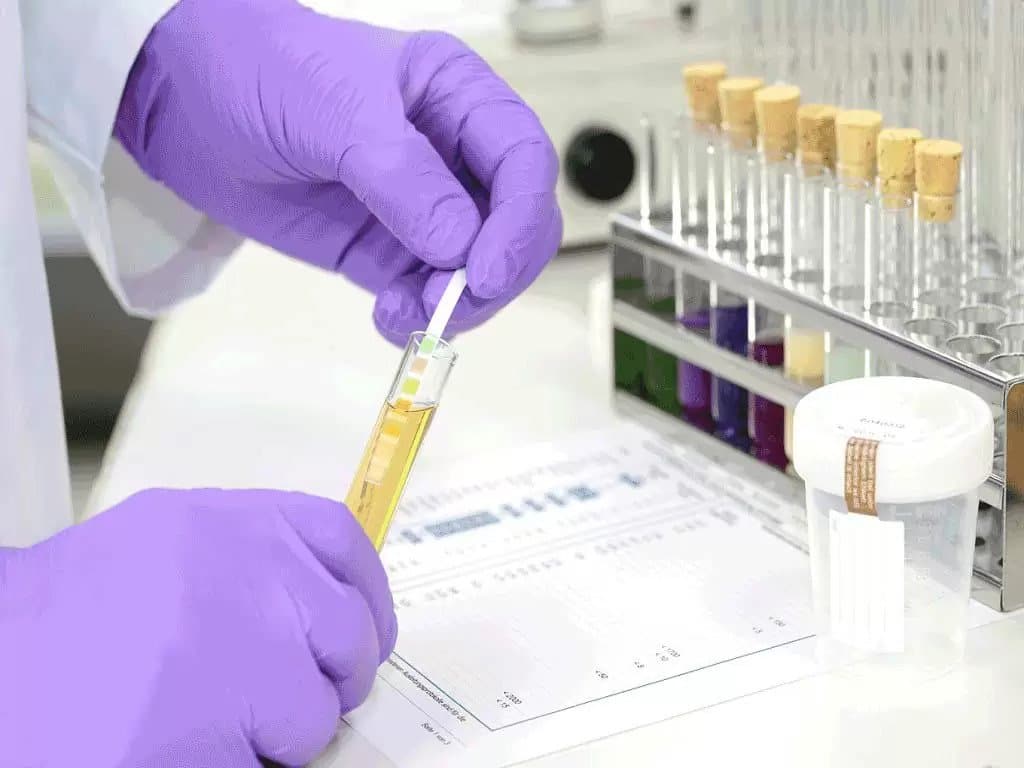 Examining a urine sample