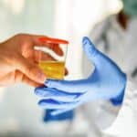 A person handing a urine sample to a lab technician