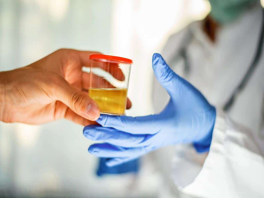 A person handing a urine sample to a lab technician