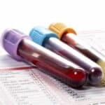 Three vials of blood on top of a document