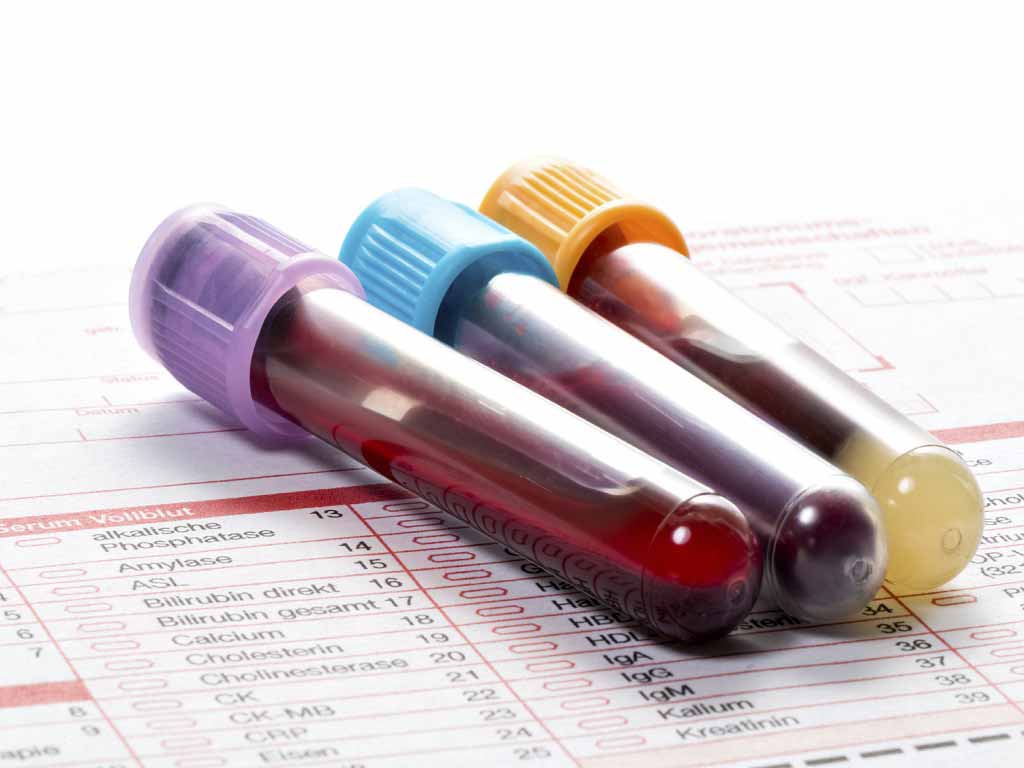 Three containers of blood samples with a piece of paper