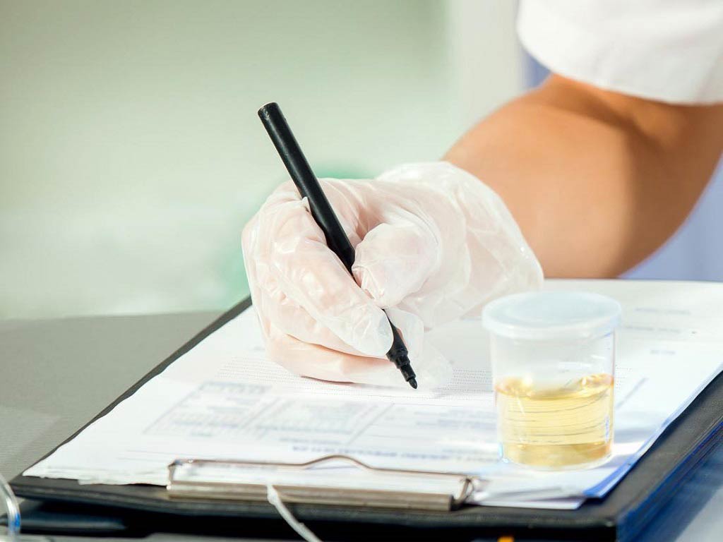 A person writing on a form with a urine cup on the side.