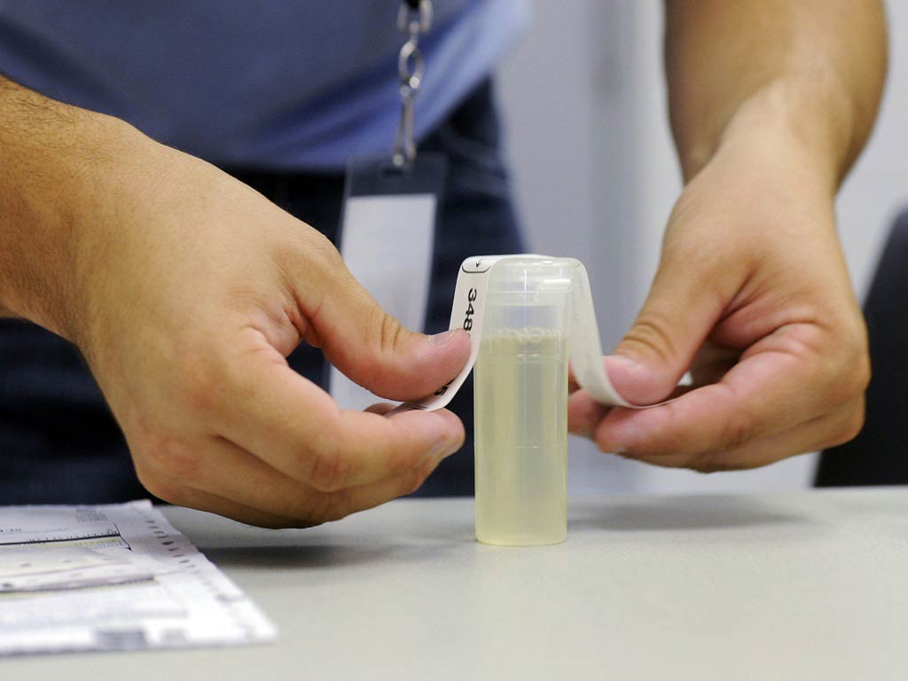 A person labelling and sealing the urine sample container