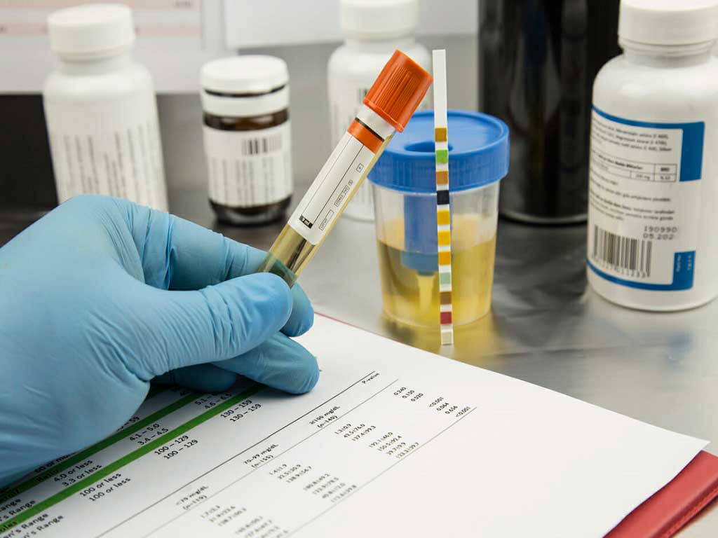 A technician holding a urine sample inside a lab