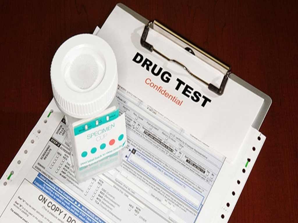 A drug test result form under a testing kit