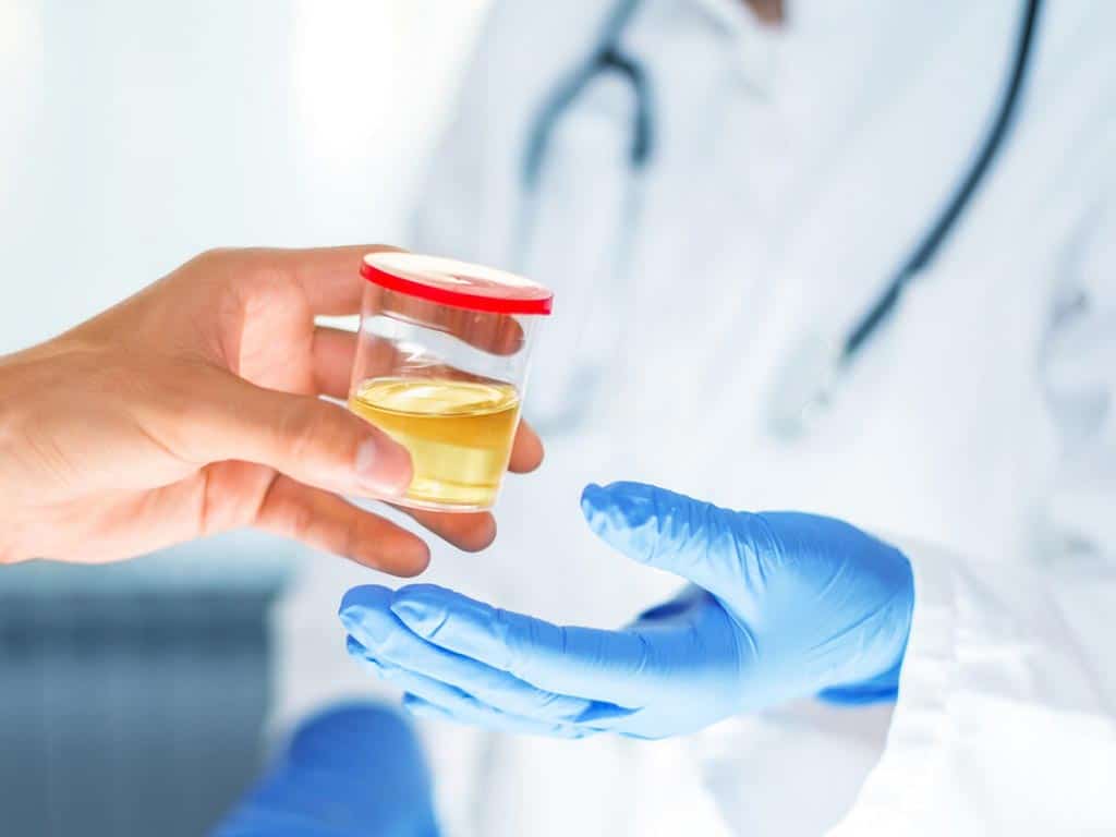 A person handing over a urine sample to a medical professional
